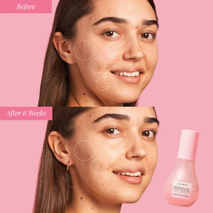 Glow Recipe Watermelon Niacinamide Dew Drops